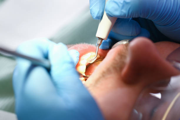 Best Mobile Emergency Dentist in Des Moines, WA